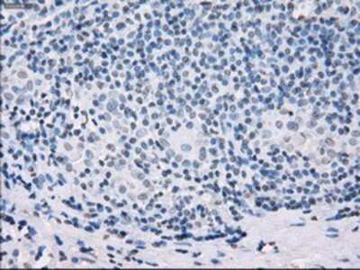 Immunohistochemistry-Paraffin: SSX2 Antibody (OTI4D10) [NBP1-48008]