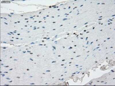 Immunohistochemistry-Paraffin: SSX2 Antibody (OTI4D10) [NBP1-48008]