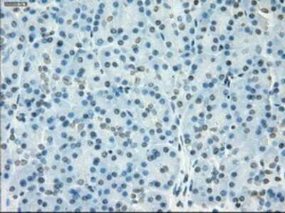Immunohistochemistry-Paraffin: SSX2 Antibody (OTI4D10) [NBP1-48008]