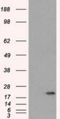 Western Blot: SSX2 Antibody (OTI4D10) [NBP1-48008]