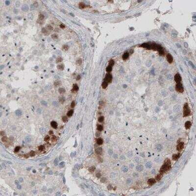 Immunohistochemistry: SSX2 Antibody (CL3202) [NBP2-42398]