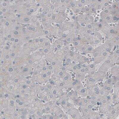 Immunohistochemistry: SSX2 Antibody (CL3202) [NBP2-42398]