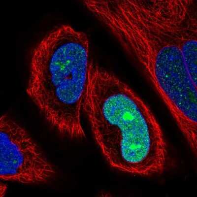 Immunocytochemistry/ Immunofluorescence: SSX2 Antibody [NBP2-46717]