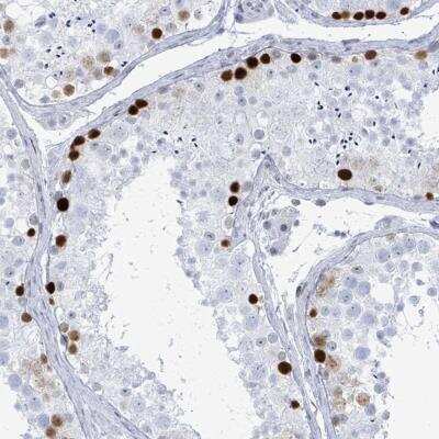 Immunohistochemistry: SSX2 Antibody [NBP2-46717]