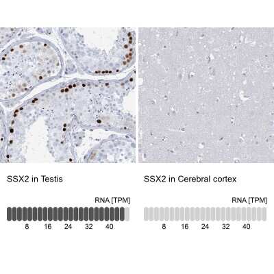 Immunohistochemistry-Paraffin: SSX2 Antibody [NBP2-46717]