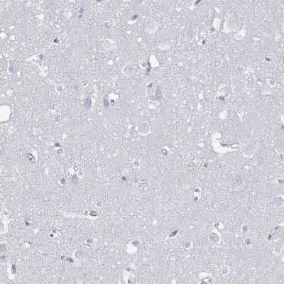 Immunohistochemistry-Paraffin: SSX2 Antibody [NBP2-46717]