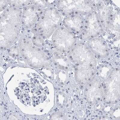 Immunohistochemistry-Paraffin: SSX2 Antibody [NBP2-46717]