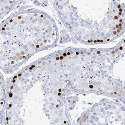 Immunohistochemistry-Paraffin: SSX2 Antibody [NBP2-46717]