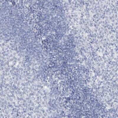 Immunohistochemistry-Paraffin: SSX2 Antibody [NBP2-46717]