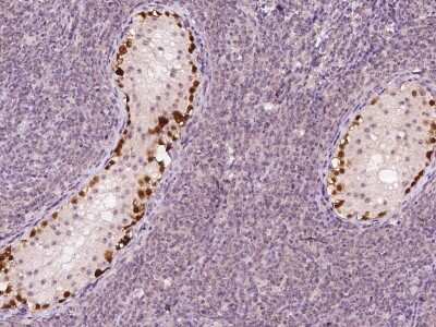 Immunohistochemistry-Paraffin: SSX2 Antibody [NBP2-98127]