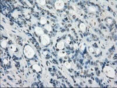 Immunohistochemistry: SSX2 Antibody (OTI4D10) - Azide and BSA Free [NBP2-74368]