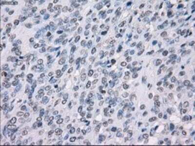 Immunohistochemistry: SSX2 Antibody (OTI4D10) - Azide and BSA Free [NBP2-74368]