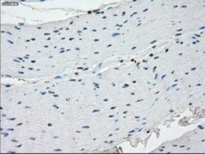 Immunohistochemistry: SSX2 Antibody (OTI4D10) - Azide and BSA Free [NBP2-74368]