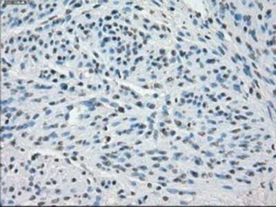 Immunohistochemistry: SSX2 Antibody (OTI4D10) - Azide and BSA Free [NBP2-74368]