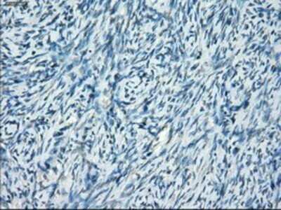 Immunohistochemistry: SSX2 Antibody (OTI4D10) - Azide and BSA Free [NBP2-74368]