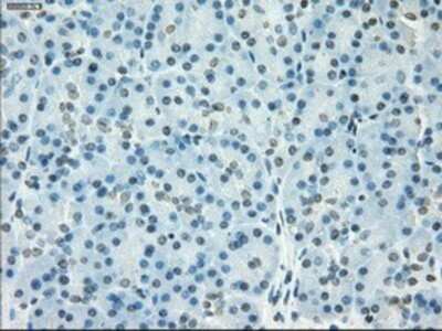 Immunohistochemistry: SSX2 Antibody (OTI4D10) - Azide and BSA Free [NBP2-74368]