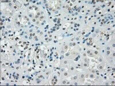 Immunohistochemistry: SSX2 Antibody (OTI4D10) - Azide and BSA Free [NBP2-74368]