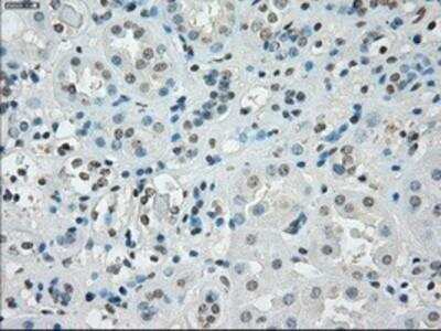 Immunohistochemistry-Paraffin: SSX2 Antibody (OTI4D10) [NBP1-48008]