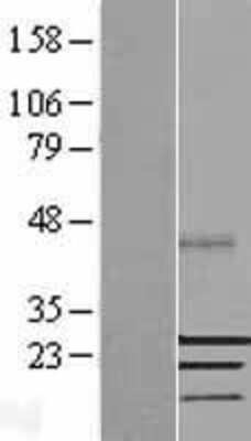 Western Blot: SSX2 Overexpression Lysate [NBL1-16484]