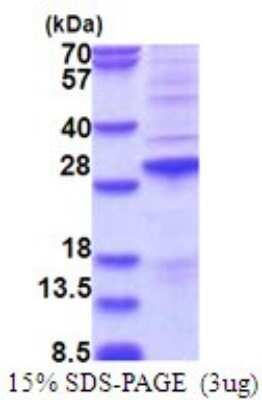 SDS-PAGE: Recombinant Human SSX2 His Protein [NBP2-51739]