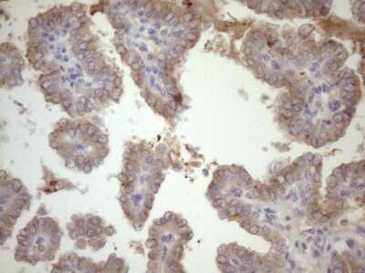 Immunohistochemistry: SSX2IP Antibody (OTI5C3) [NBP2-45458]
