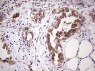 Immunohistochemistry: SSX2IP Antibody (OTI5C3) - Azide and BSA Free [NBP2-74369]