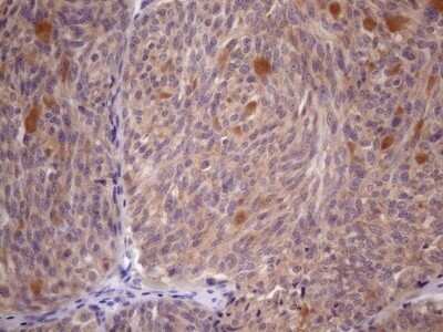 Immunohistochemistry: SSX2IP Antibody (OTI5C3) - Azide and BSA Free [NBP2-74369]