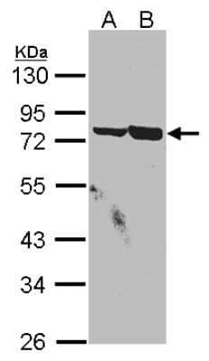 Western Blot: SSX2IP Antibody [NBP1-30987]