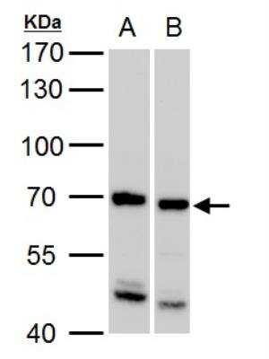 Western Blot: SSX2IP Antibody [NBP1-30987]