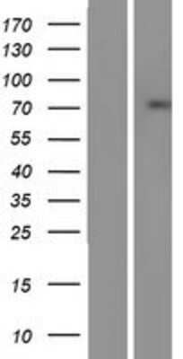 Western Blot: SSX2IP Overexpression Lysate [NBP2-07390]