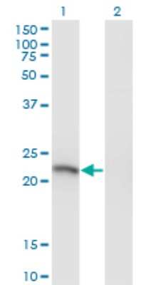 Western Blot: SSX3 Antibody (4A11) [H00010214-M03]