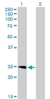 Western Blot: SSX3 Antibody [H00010214-B01P]