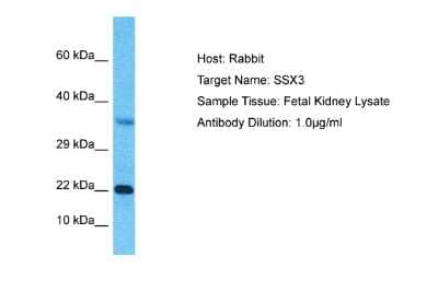 Western Blot: SSX3 Antibody [NBP2-86831]