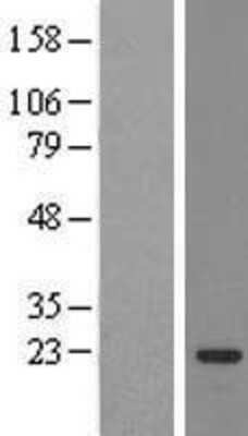 Western Blot: SSX3 Overexpression Lysate [NBL1-16486]