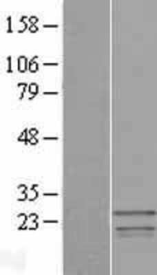 Western Blot: SSX3 Overexpression Lysate [NBP2-06576]