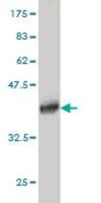 Western Blot: SSX4 Antibody (3E10) [H00006759-M02]