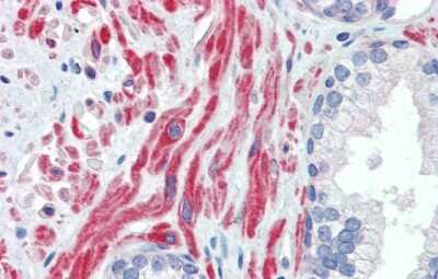 Immunohistochemistry: SSX4 Antibody [NBP2-86833]