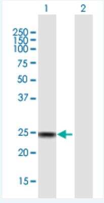 Western Blot: SSX4 Antibody [H00006759-B01P-50ug]