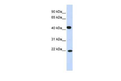 Western Blot: SSX4 Antibody [NBP2-86832]