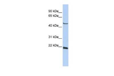 Western Blot: SSX4 Antibody [NBP2-86833]