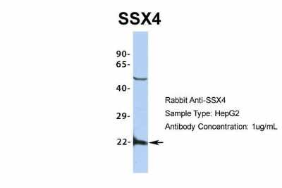 Western Blot: SSX4 Antibody [NBP2-86833]