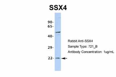 Western Blot: SSX4 Antibody [NBP2-86833]