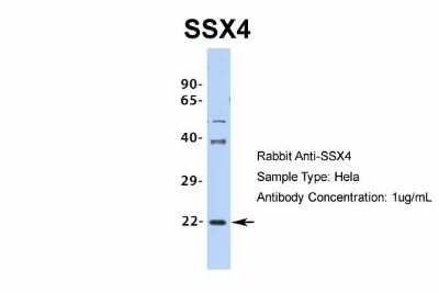 Western Blot: SSX4 Antibody [NBP2-86833]