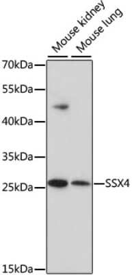 Western Blot: SSX4 AntibodyAzide and BSA Free [NBP2-93153]