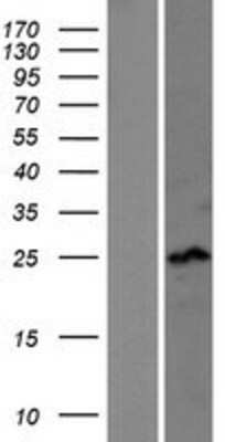 Western Blot: SSX4 Overexpression Lysate [NBL1-16487]