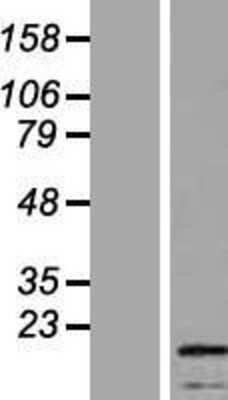 Western Blot: SSX4 Overexpression Lysate [NBP2-05059]