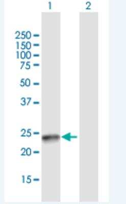 Western Blot: SSX4B Antibody [H00548313-B01P-50ug]