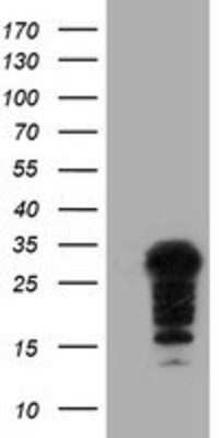 Western Blot: SSX5 Antibody (OTI3G6) [NBP2-01842]