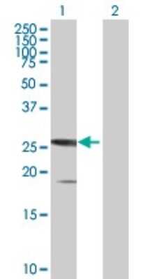 Western Blot: SSX5 Antibody [H00006758-B01P]