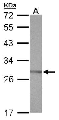 Western Blot: SSX5 Antibody [NBP2-20489]